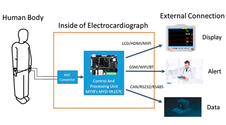 Medical Applications based on STM32MP1 - Electrocardiogram (ECG) Monitor Solution